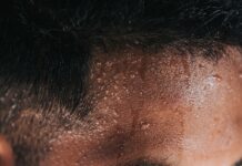 “땀이 너무 많이 나요”…초여름 ‘다한증’ 관리법 mans face in close up