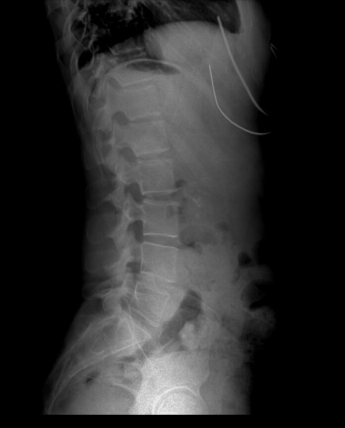 A black and white photo of a man's back